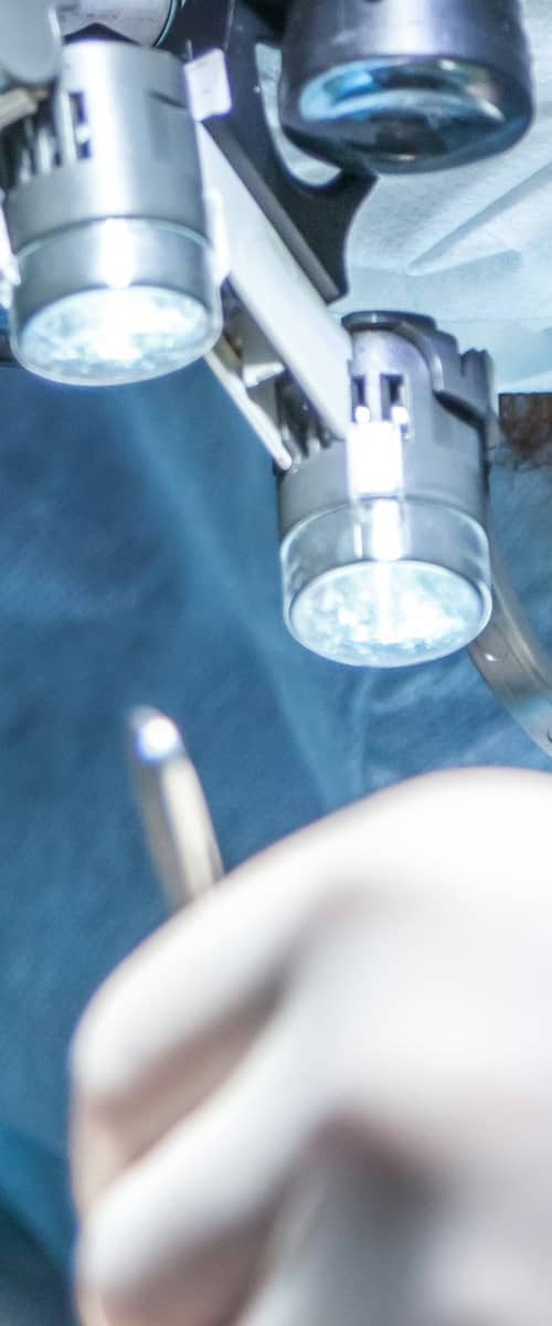 Surgeon performing Cataract Surgery